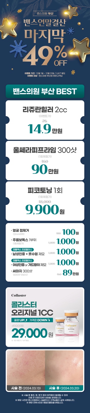 [12월 한정특가]울쎄라 300샷 + 피팅리프팅 40KJ 외 상세 이미지 2
